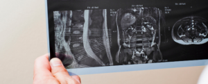 Stonebridge - How to become a Radiology Technician?