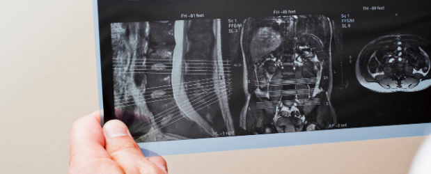 Stonebridge - How to become a Radiology Technician?